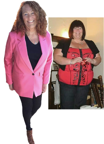 The Weight's Over: Take Back Control Lorraine before and after